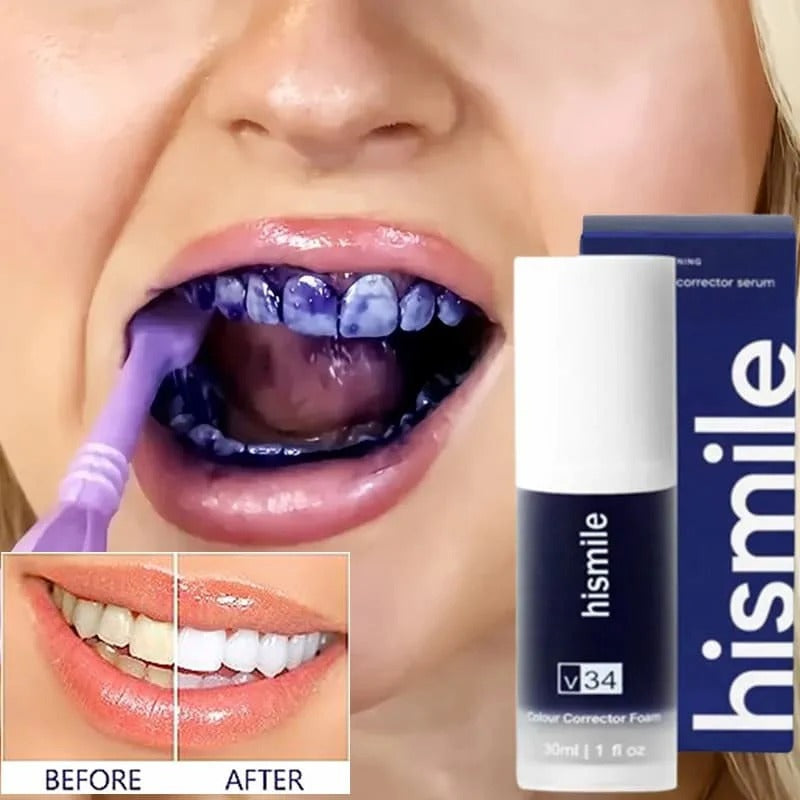 Hismile v34 Colour Corrector